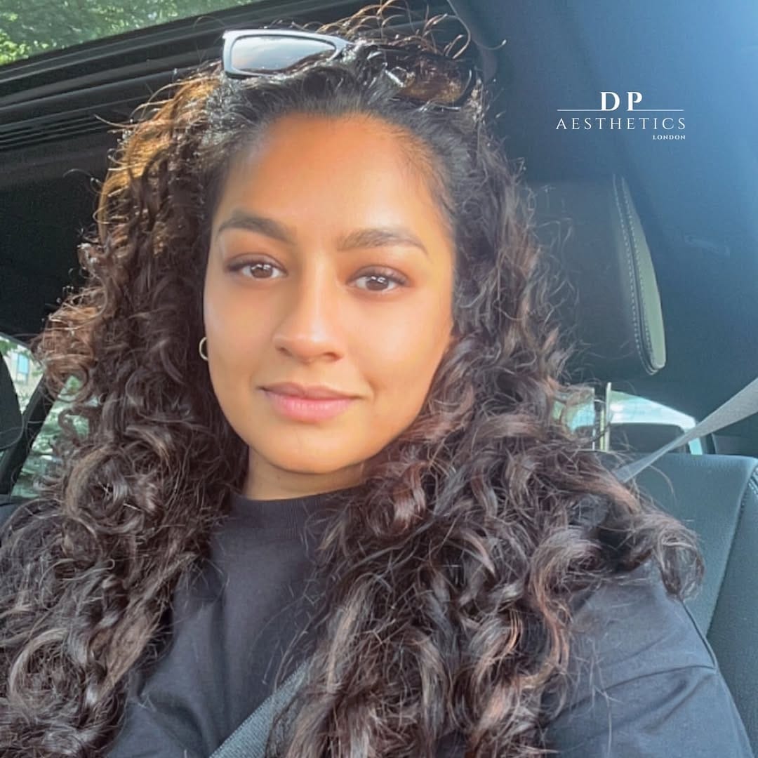 Post 8 by Dolly | HYDRAFACIAL | LIP FILLERS | SKIN BOOSTERS on Instagram (image)