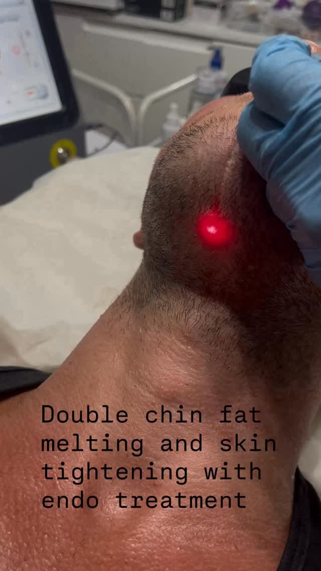 Post 1 by SKIN EXPERT CLINIC & ACADEMY on Instagram (video)