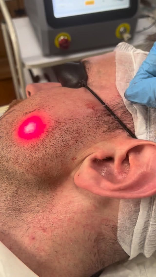 Post 2 by SKIN EXPERT CLINIC & ACADEMY on Instagram (video)