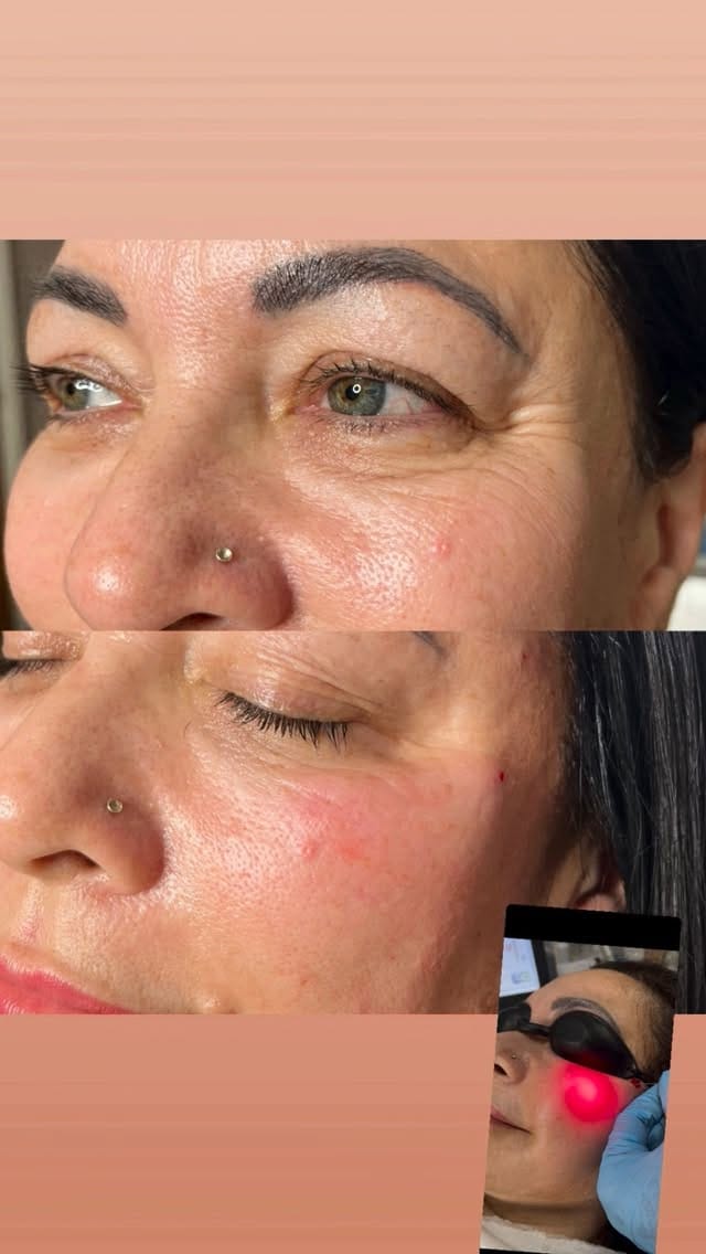 Post 8 by SKIN EXPERT CLINIC & ACADEMY on Instagram (video)