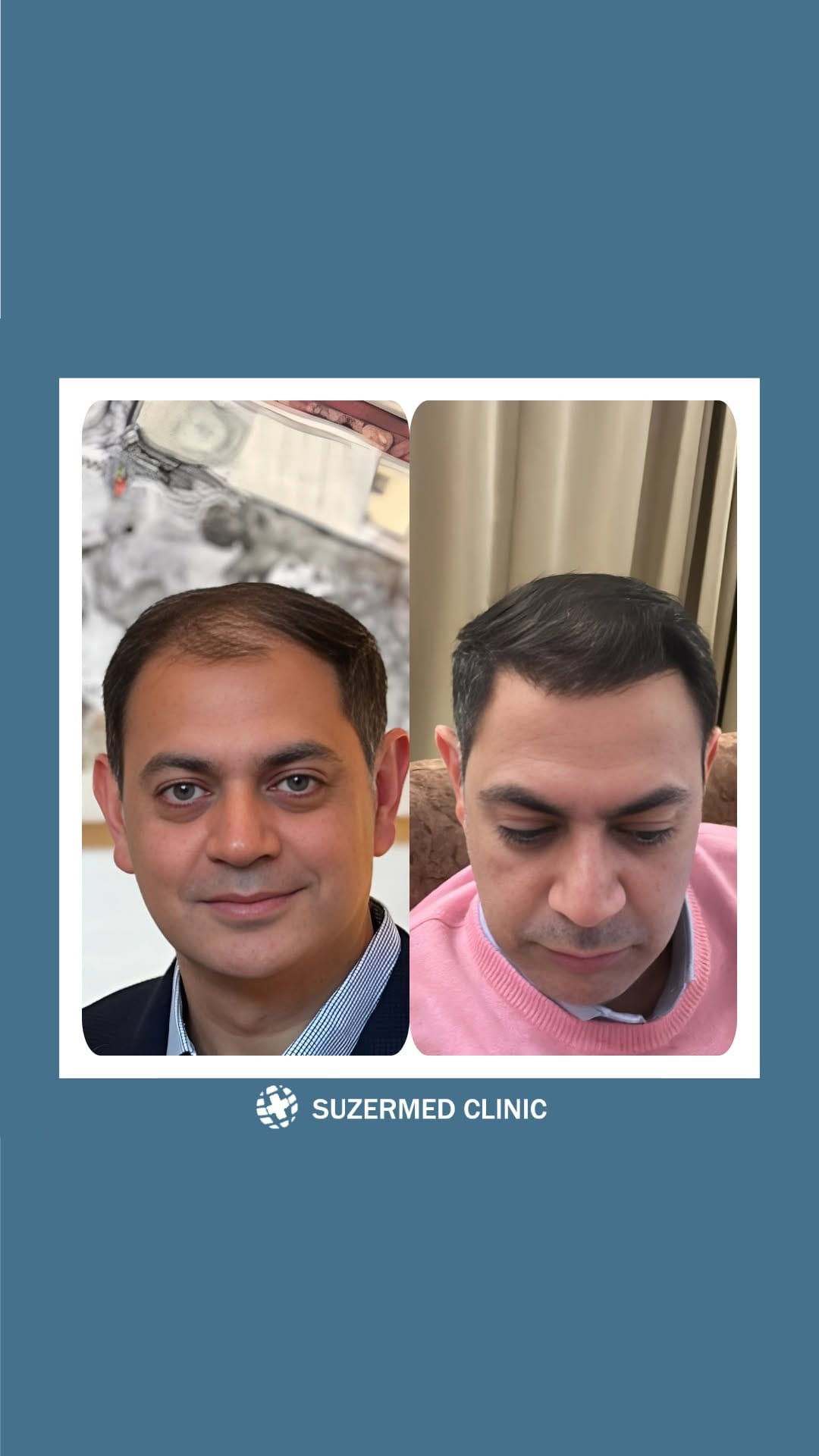 Post 6 by Suzermed Clinic on Instagram (video)