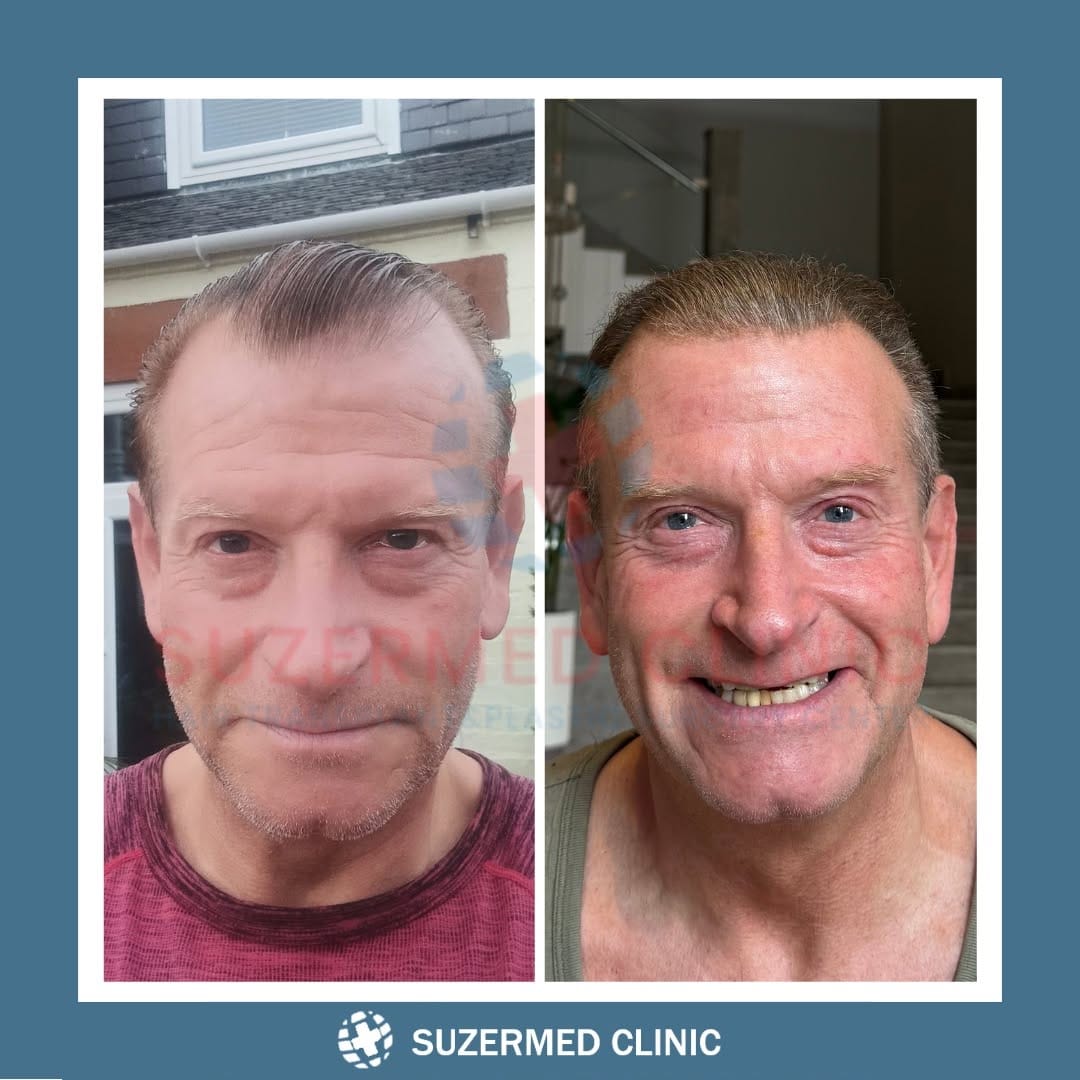 Post 5 by Suzermed Clinic on Instagram (image)