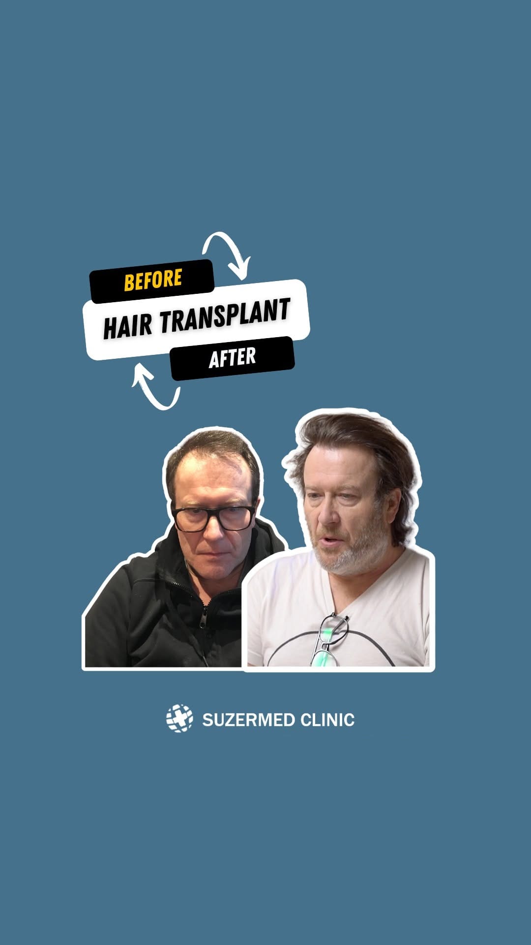 Post 10 by Suzermed Clinic on Instagram (video)
