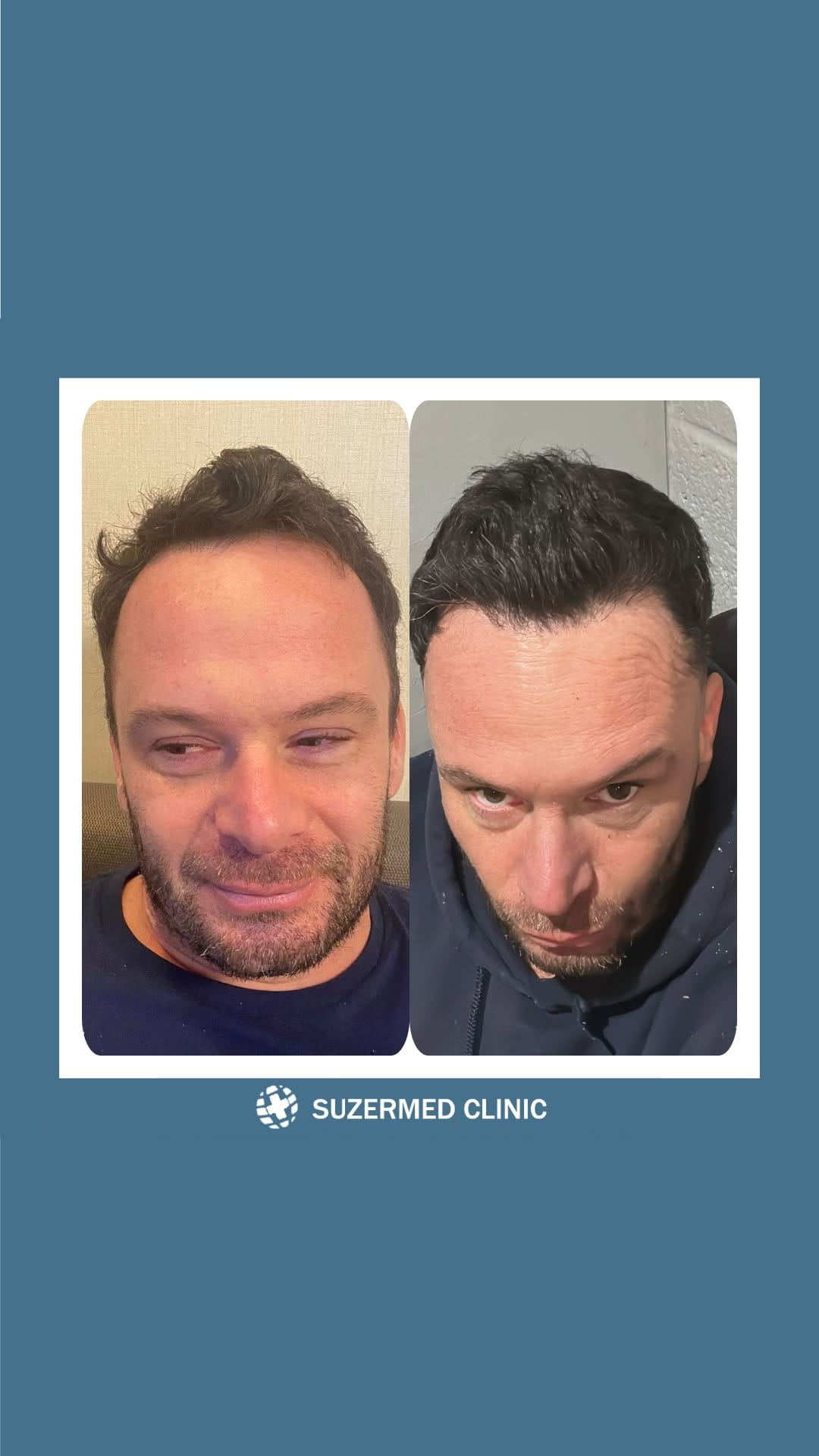 Post 8 by Suzermed Clinic on Instagram (video)