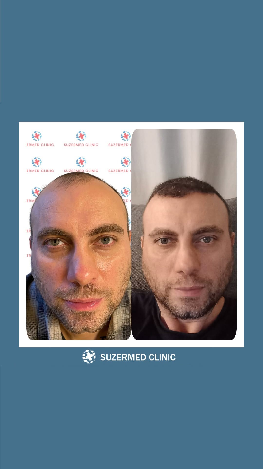 Post 7 by Suzermed Clinic on Instagram (video)