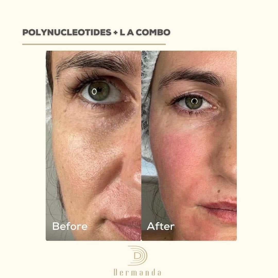 Post 8 by DERMANDA CLINIC on Instagram (image)