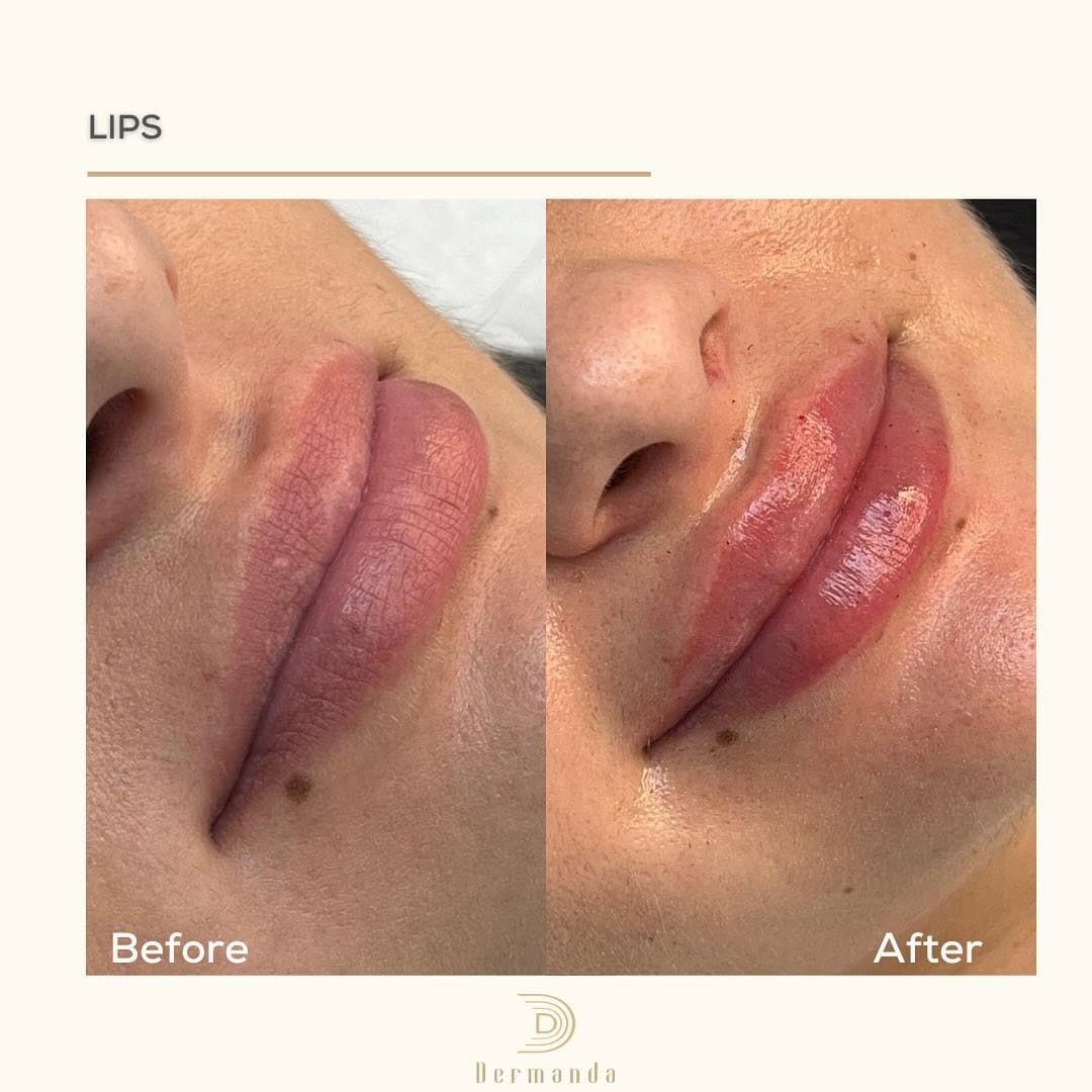 Post 9 by DERMANDA CLINIC on Instagram (image)
