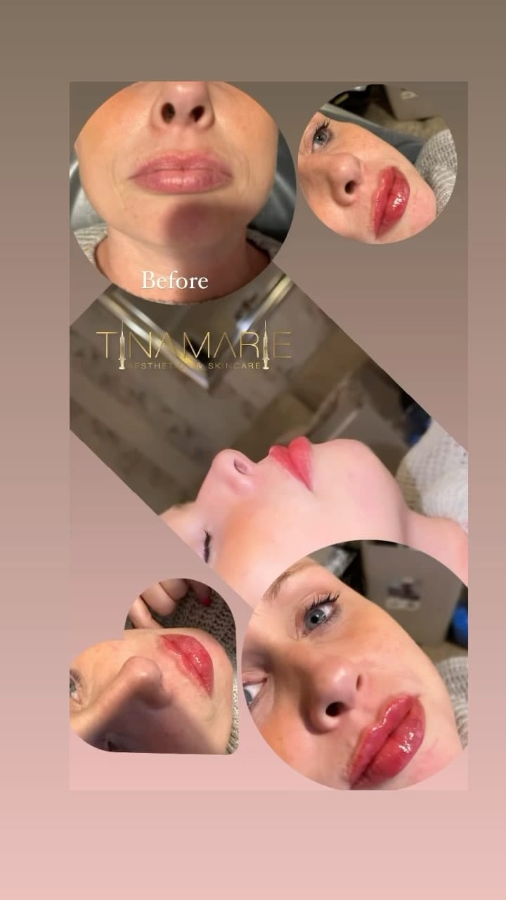 Post 9 by Tina Marie Aesthetics & Skincare on Instagram (video)