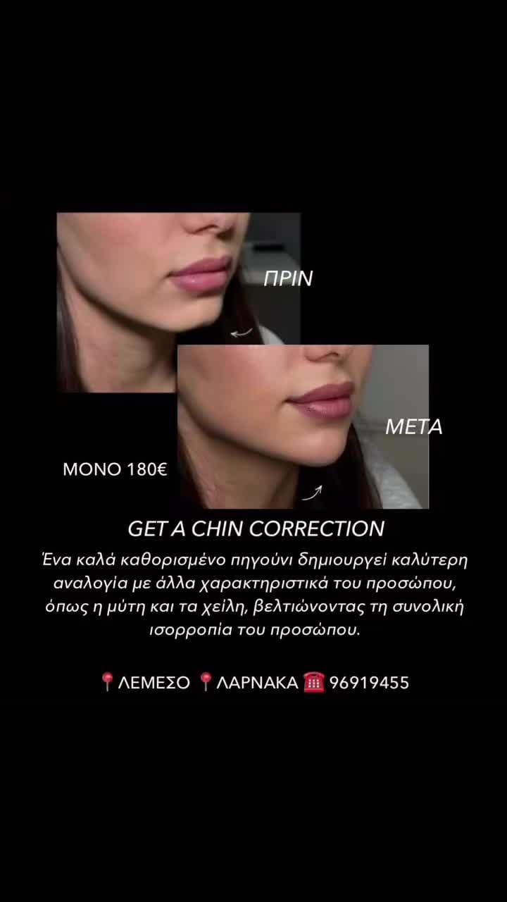 Post 1 by Clinical Aesthetics & Wellbeing  🇨🇾🇬🇷🇬🇧 on Instagram (video)