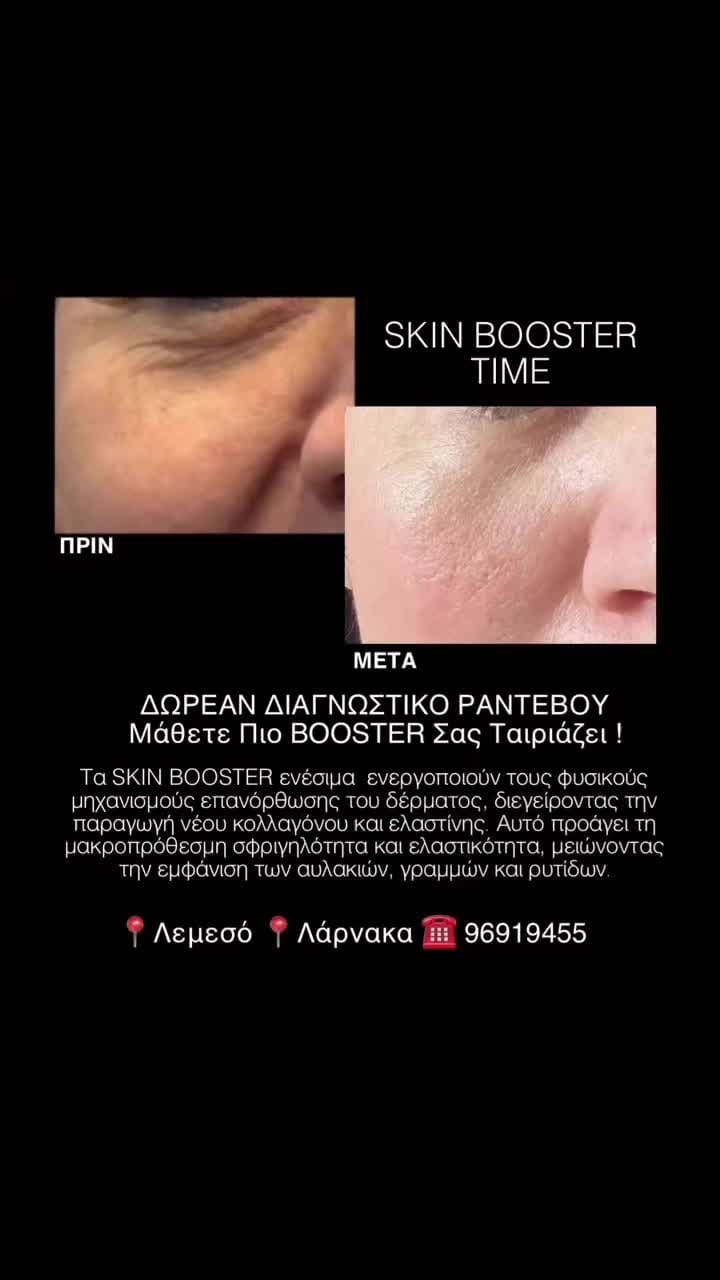 Post 10 by Clinical Aesthetics & Wellbeing  🇨🇾🇬🇷🇬🇧 on Instagram (video)