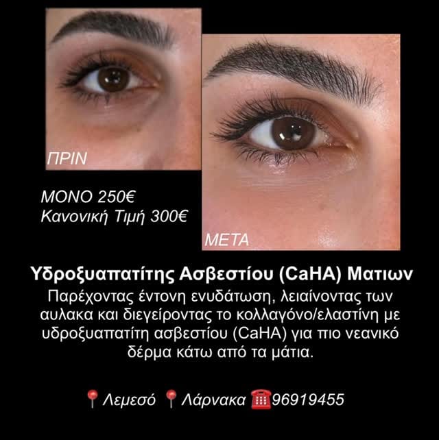 Post 8 by Clinical Aesthetics & Wellbeing  🇨🇾🇬🇷🇬🇧 on Instagram (video)