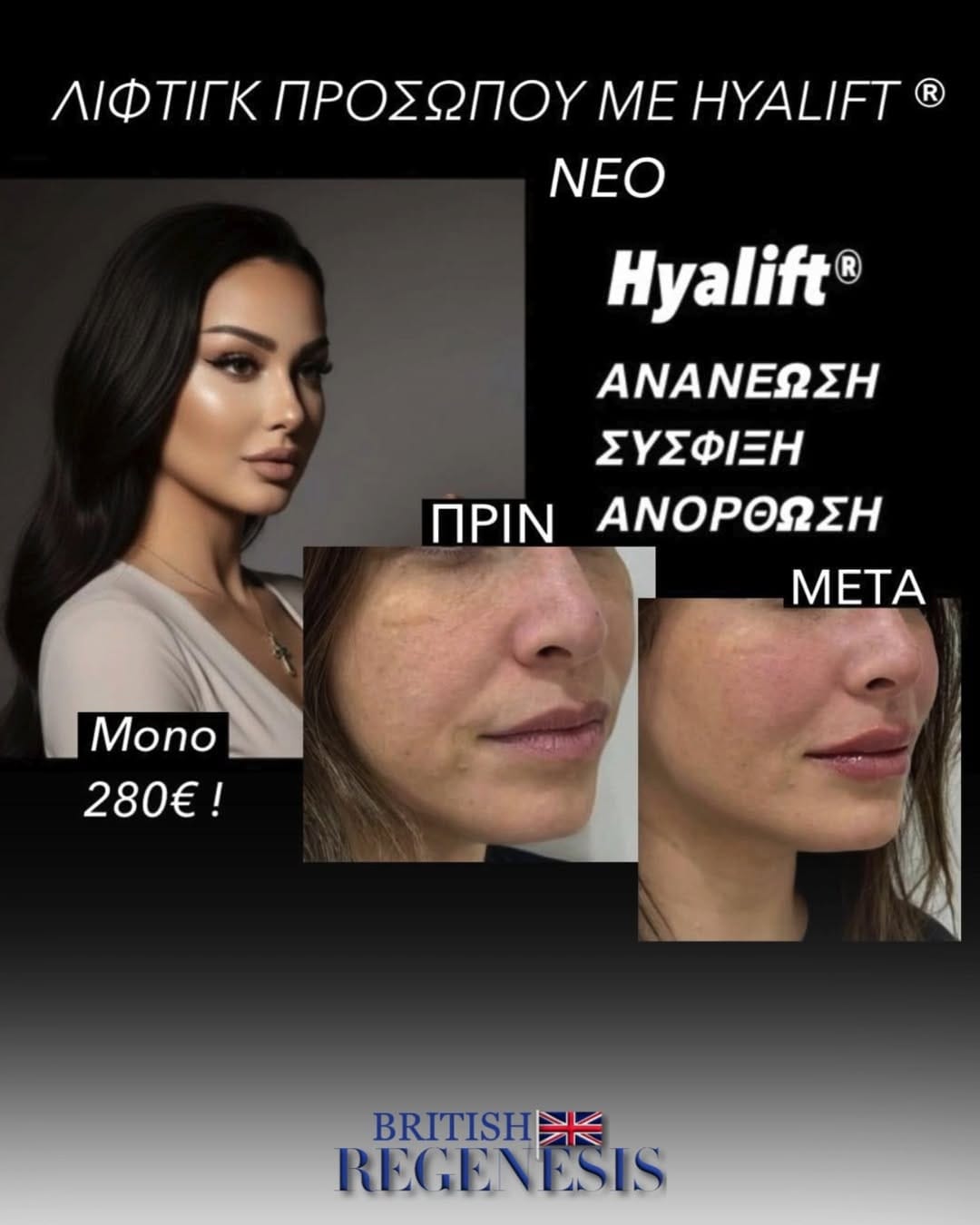 Post 3 by Clinical Aesthetics & Wellbeing  🇨🇾🇬🇷🇬🇧 on Instagram (video)