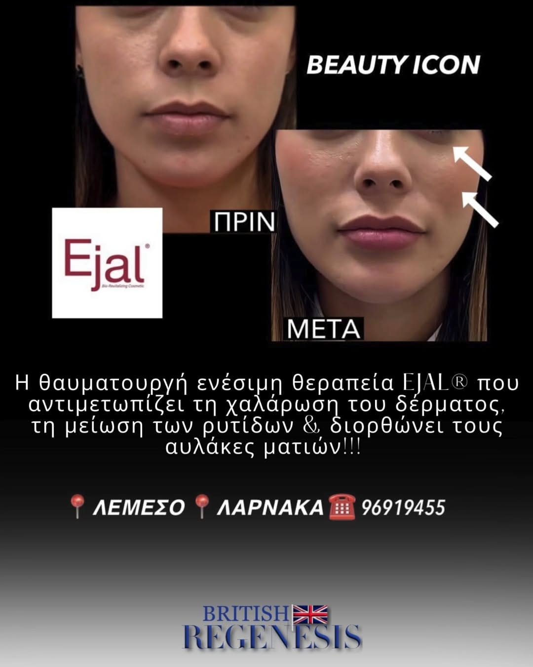 Post 2 by Clinical Aesthetics & Wellbeing  🇨🇾🇬🇷🇬🇧 on Instagram (video)