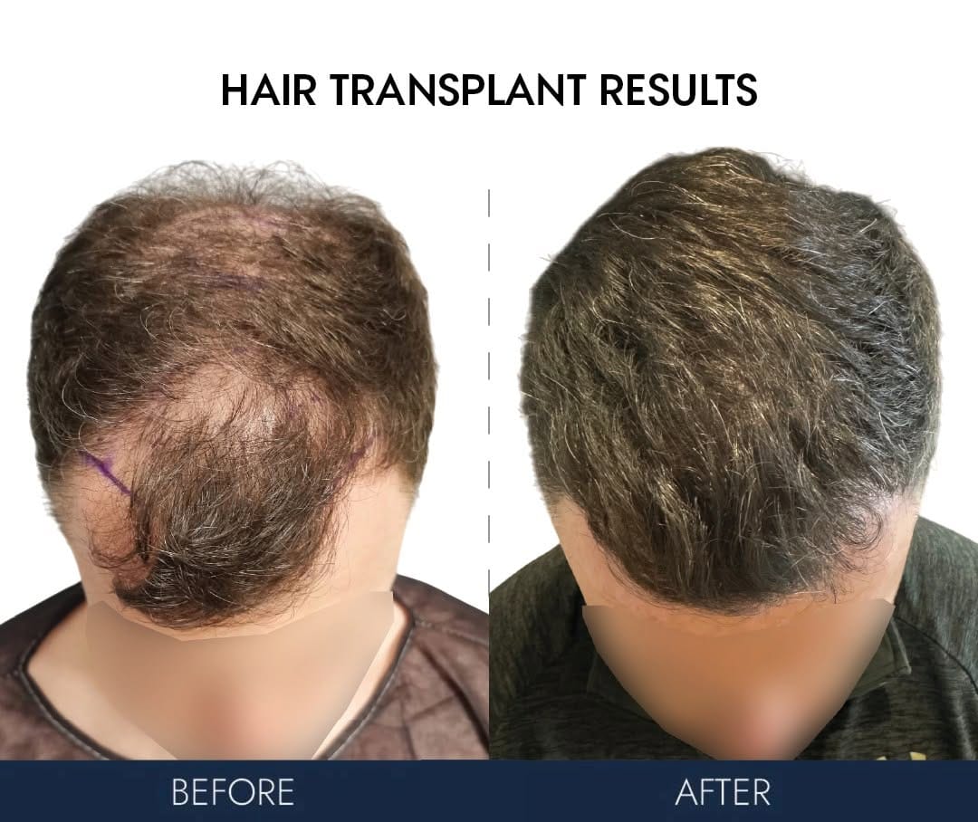 Post 7 by Ailesbury Hair Fleming Place Clinic on Instagram (image)