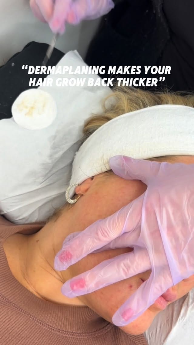Post 6 by Maisiemay’s | Advanced Aesthetics Practitioner | Sidcup, Kent on Instagram (video)