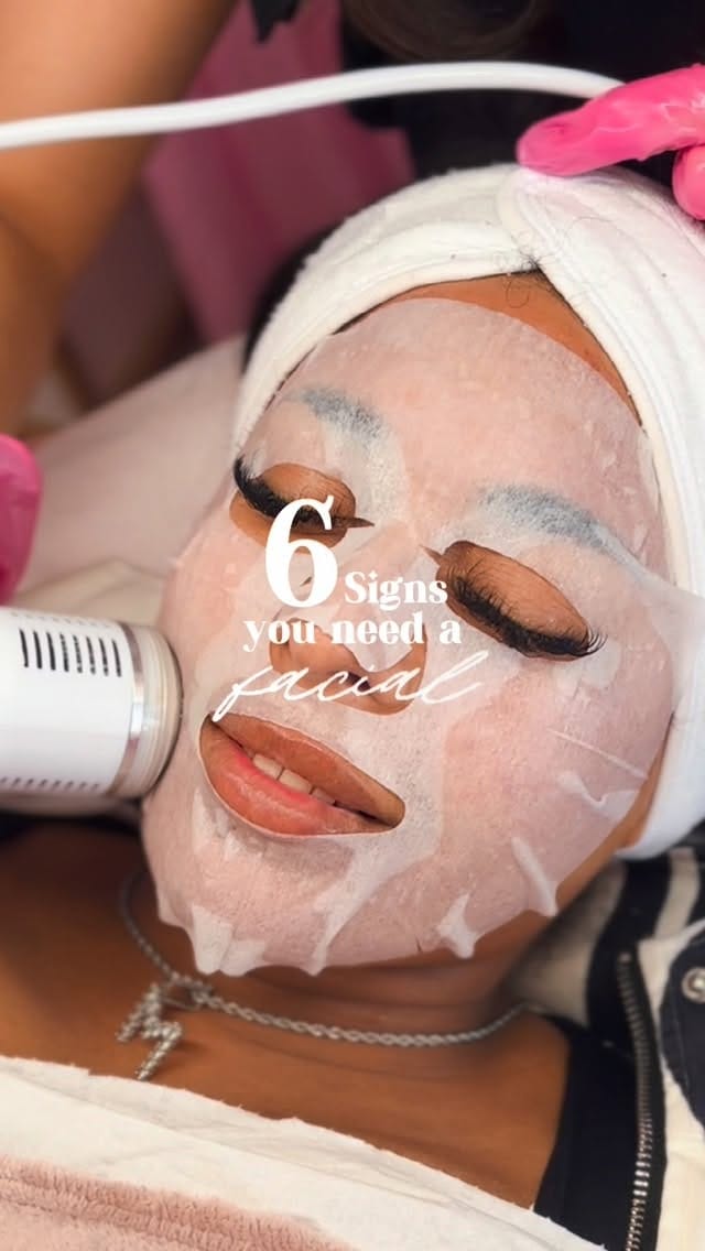 Post 8 by Maisiemay’s | Advanced Aesthetics Practitioner | Sidcup, Kent on Instagram (video)
