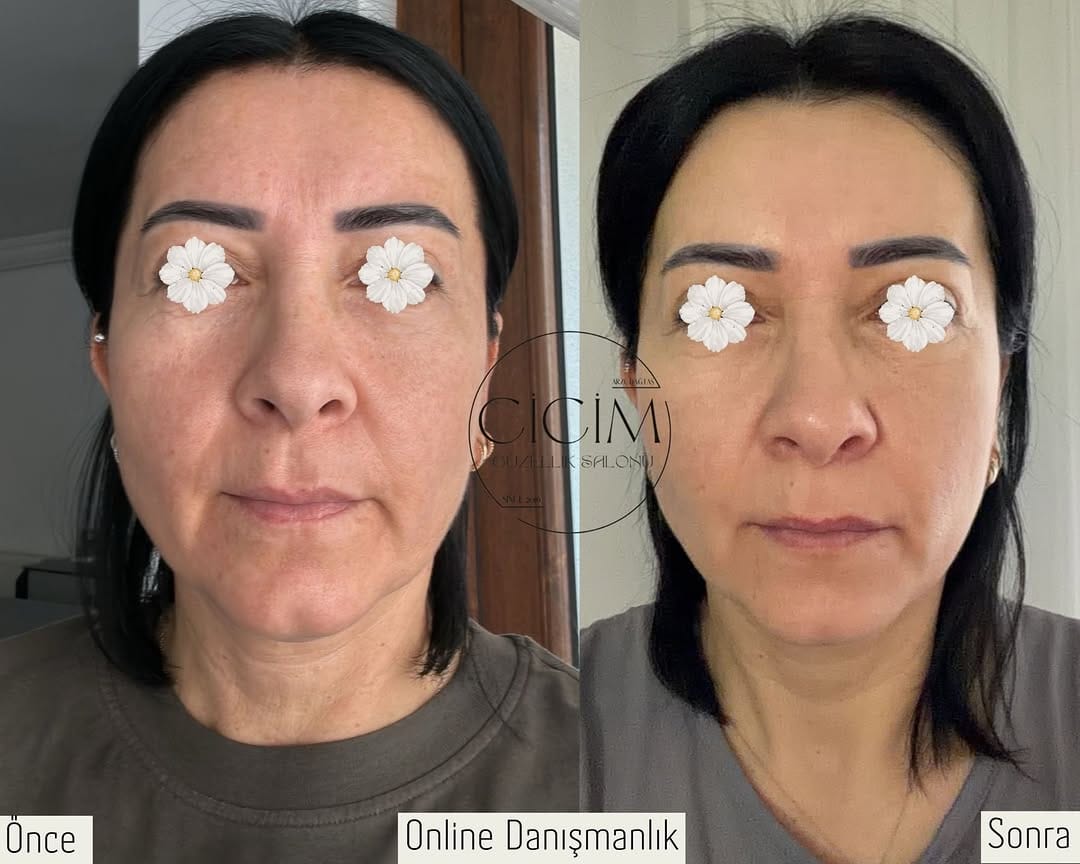 Post 2 by Arzu Dağtaş on Instagram (image)