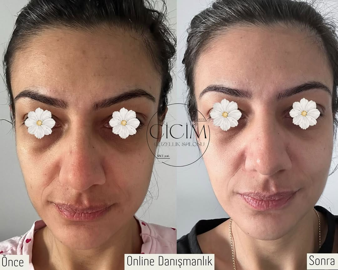 Post 5 by Arzu Dağtaş on Instagram (image)