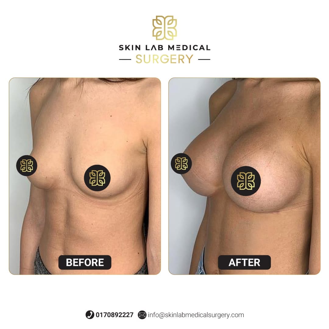 Post 1 by Skin Lab Medical Plastic Surgery’s and Hair Transplant on Instagram (image)