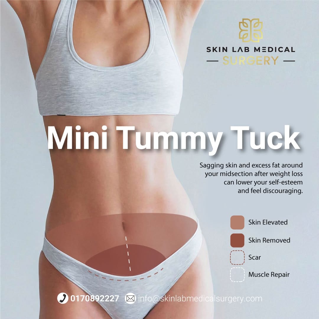 Post 5 by Skin Lab Medical Plastic Surgery’s and Hair Transplant on Instagram (image)