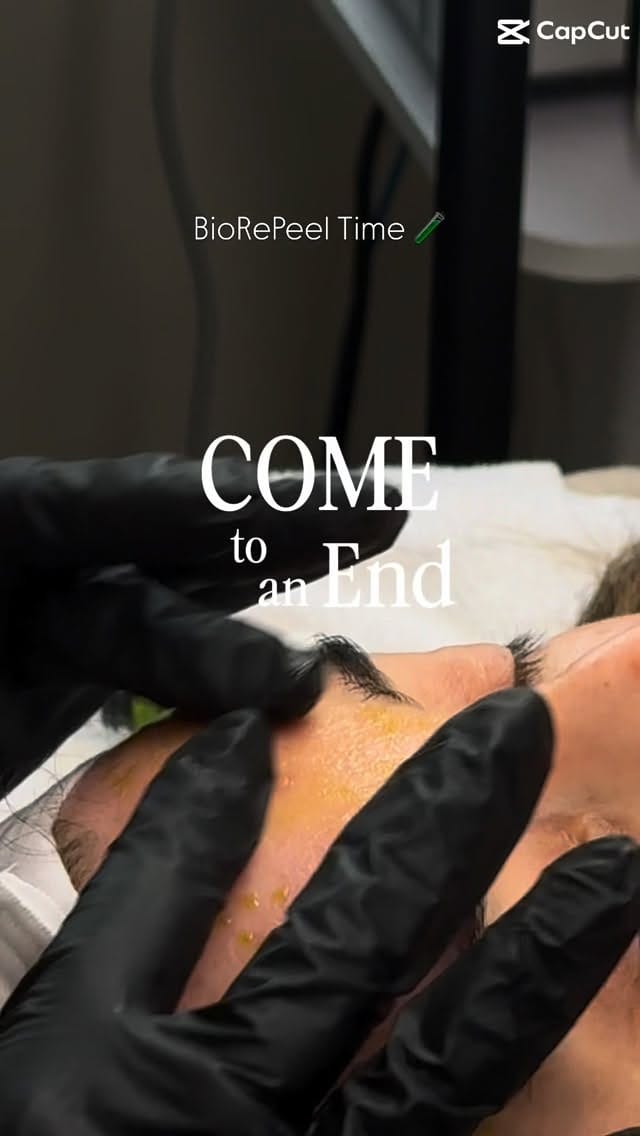 Post 7 by The Skin Space | Acne Specialist on Instagram (video)