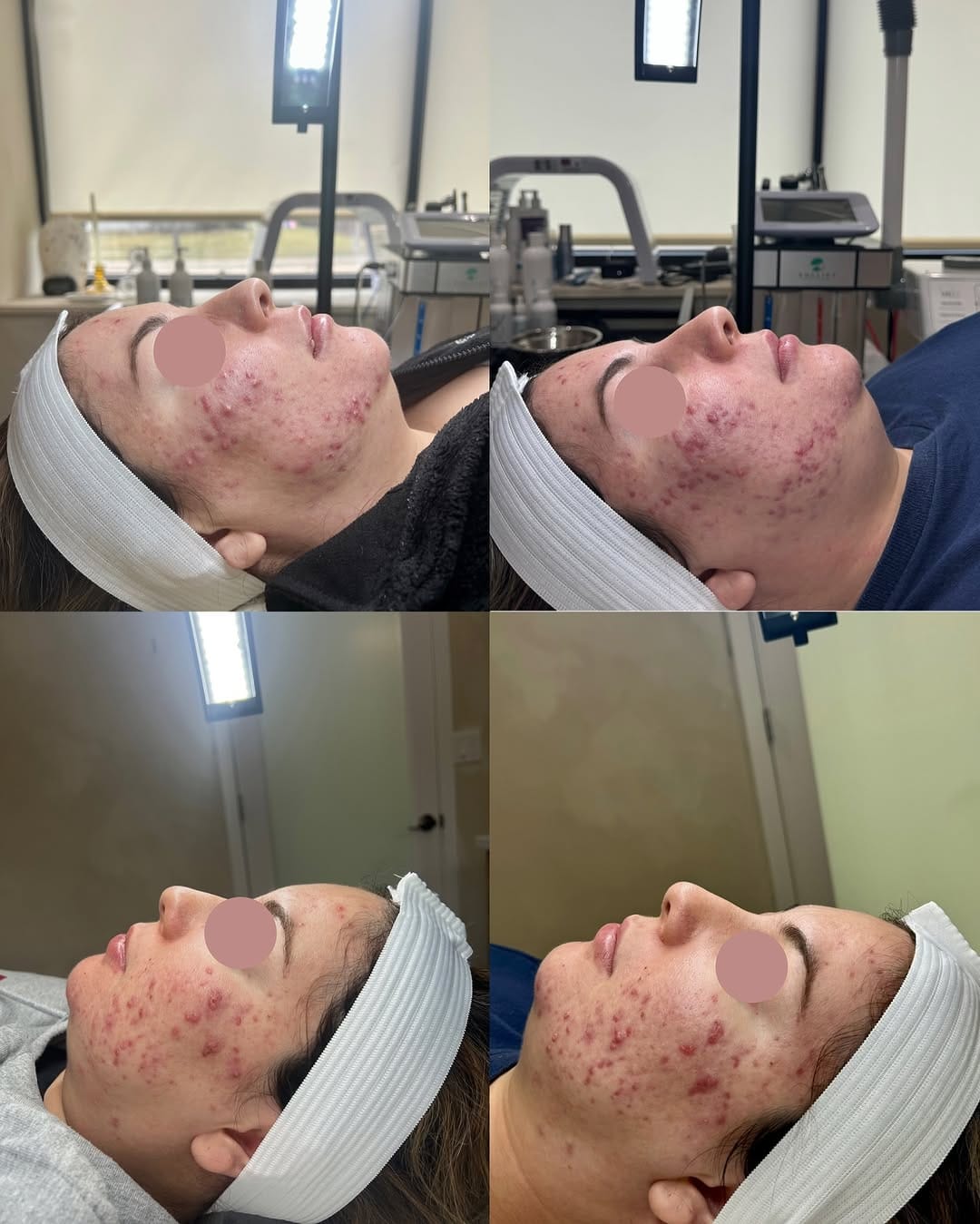 Post 8 by The Skin Space | Acne Specialist on Instagram (carousel)
