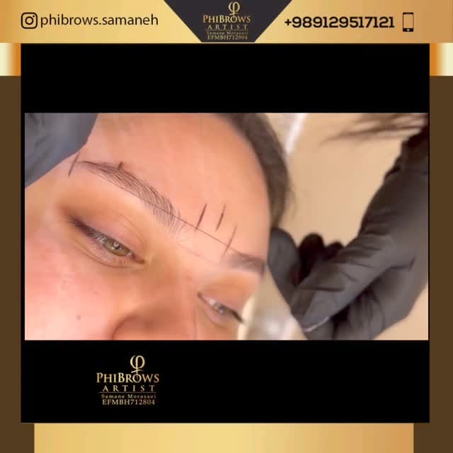 Post 9 by کلینیک زیبایی/ میکروبلیدینگ on Instagram (video)