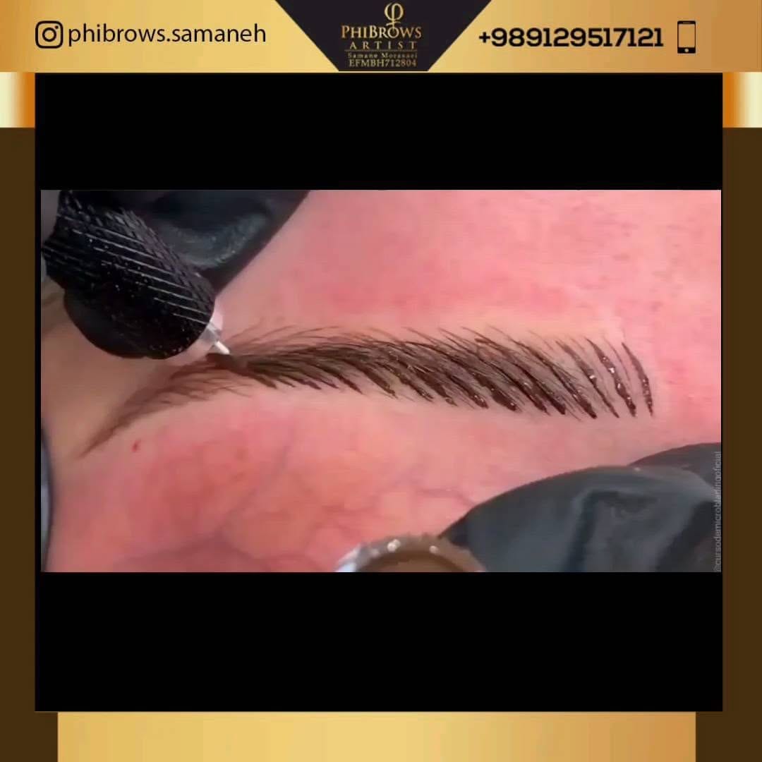 Post 7 by کلینیک زیبایی/ میکروبلیدینگ on Instagram (video)
