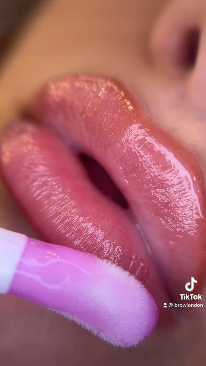 Post 10 by Microblading, Lip fillers, Lip blush, Fat dissolving on Instagram (video)