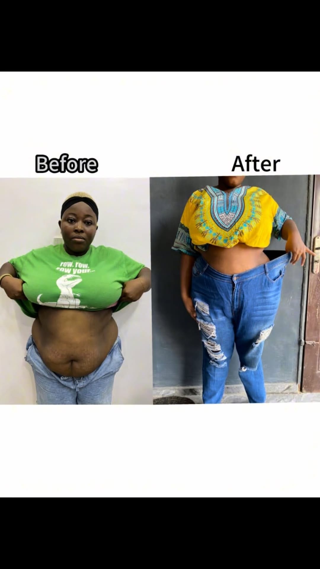 Post 9 by Weight Loss, Fat Dissolving, Body Contouring on Instagram (video)