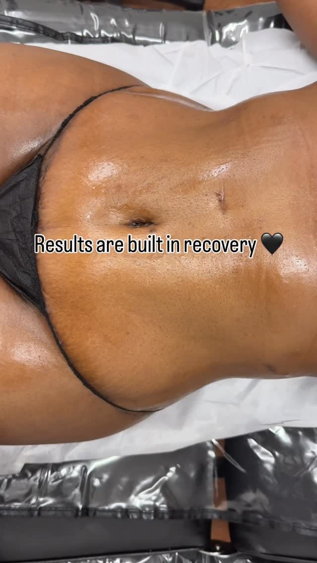 Post 3 by Weight Loss, Fat Dissolving, Body Contouring on Instagram (video)