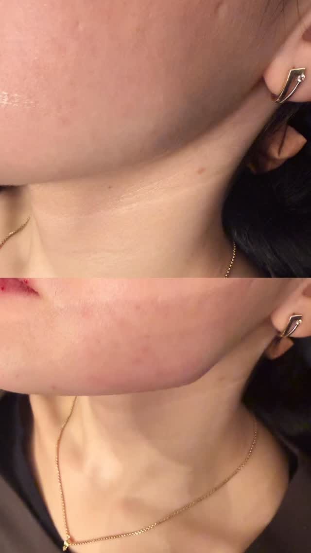Post 1 by Celebrity Training Academy & Clinic 💉 on Instagram (video)