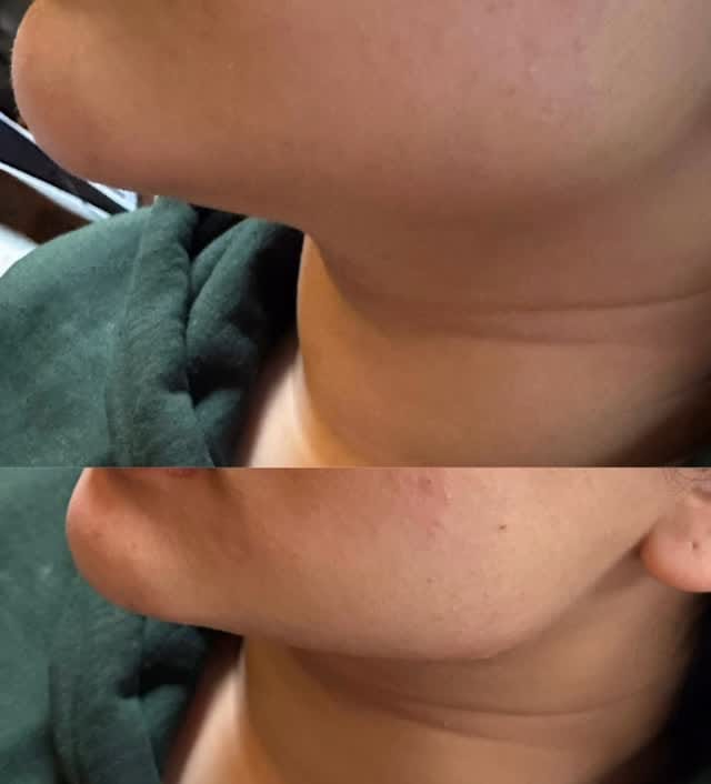 Post 9 by Celebrity Training Academy & Clinic 💉 on Instagram (video)