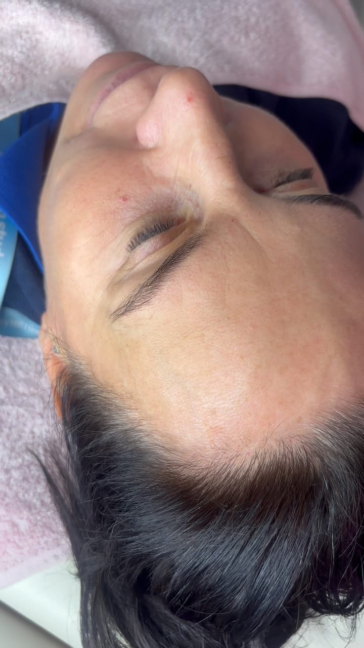 Post 7 by B🧿N💉🌴A | SKIN SPECIALIST | AESTHETICS on Instagram (video)