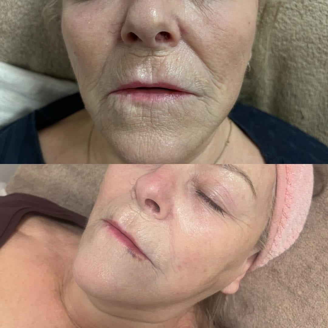 Post 5 by Aesthetics Wirral and Liverpool on Instagram (image)