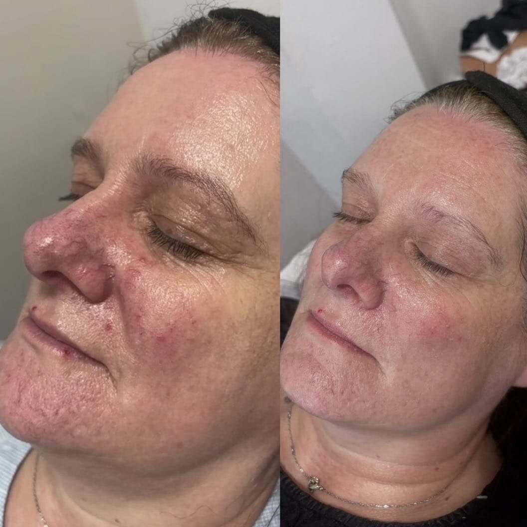 Post 8 by Aesthetics Wirral and Liverpool on Instagram (image)