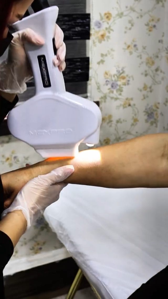 Post 7 by livmedgüzelliksalonu on Instagram (video)