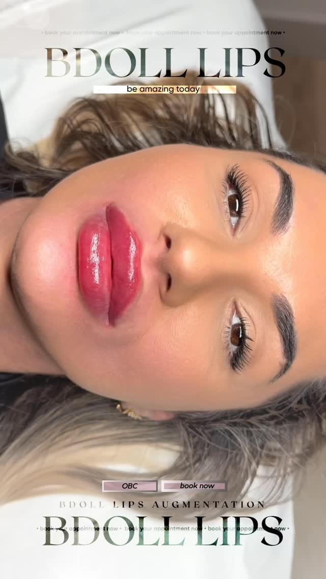 Post 3 by RUSSIAN LIPS, FILLERS, STRIP/LIPS, AESTHETICS & TRAINING on Instagram (video)
