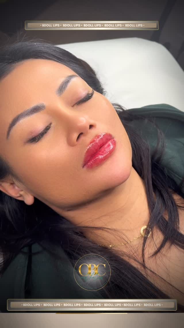 Post 7 by RUSSIAN LIPS, FILLERS, STRIP/LIPS, AESTHETICS & TRAINING on Instagram (video)