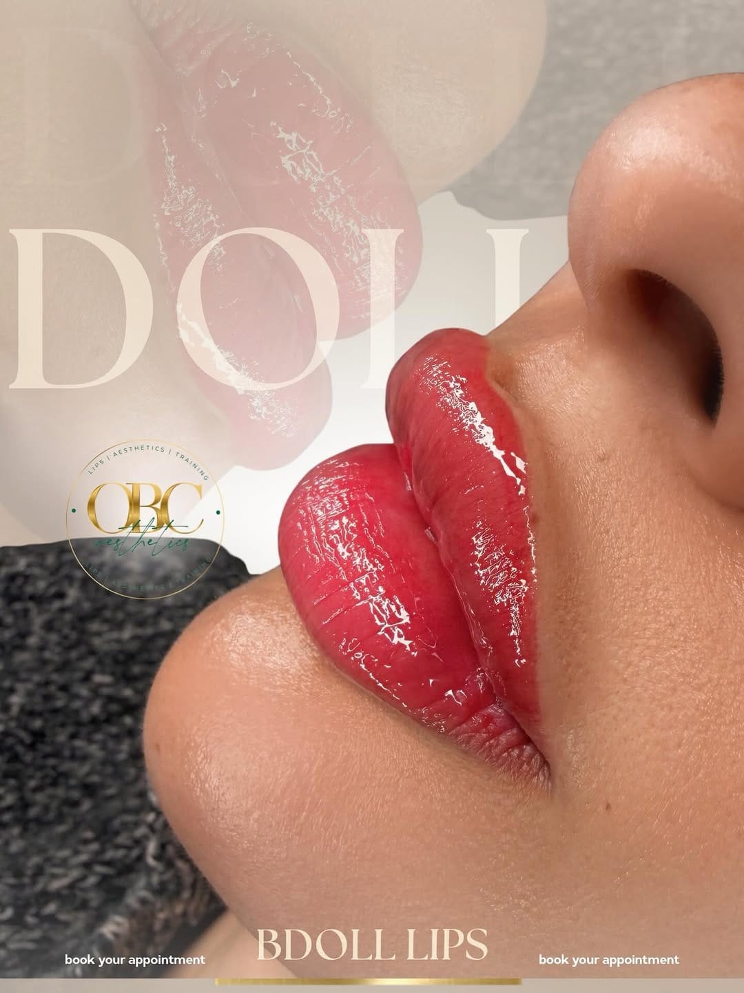Post 4 by RUSSIAN LIPS, FILLERS, STRIP/LIPS, AESTHETICS & TRAINING on Instagram (image)