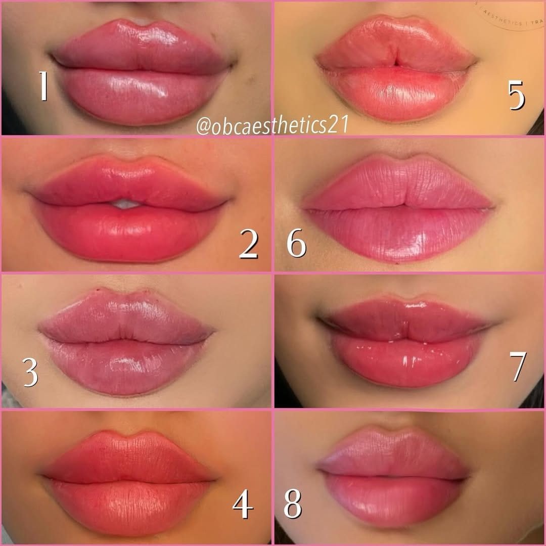 Post 10 by RUSSIAN LIPS, FILLERS, STRIP/LIPS, AESTHETICS & TRAINING on Instagram (image)
