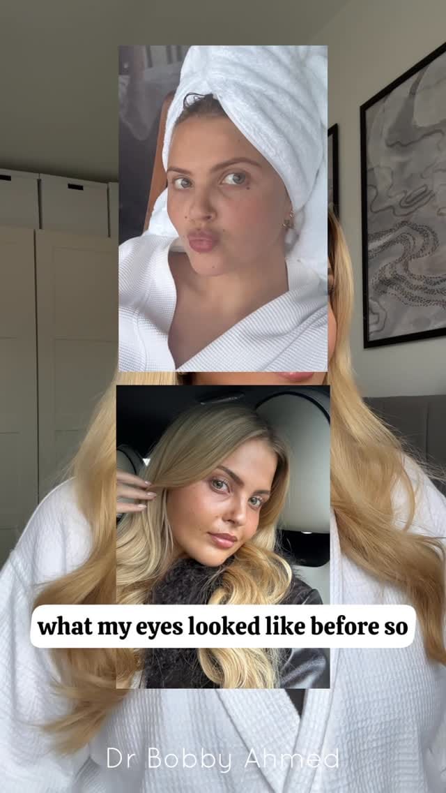 Post 1 by Dr. Bobby Ahmed on Instagram (video)