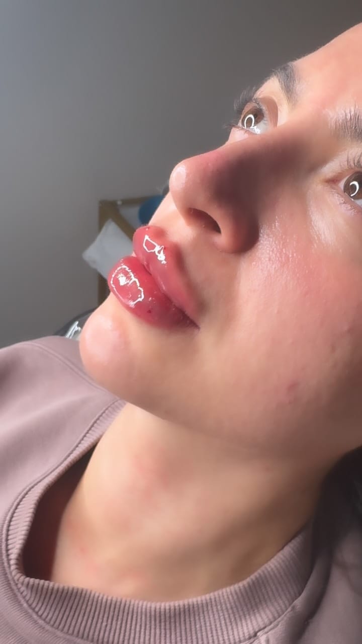 Post 6 by Camila Firetto Aesthetics on Instagram (video)