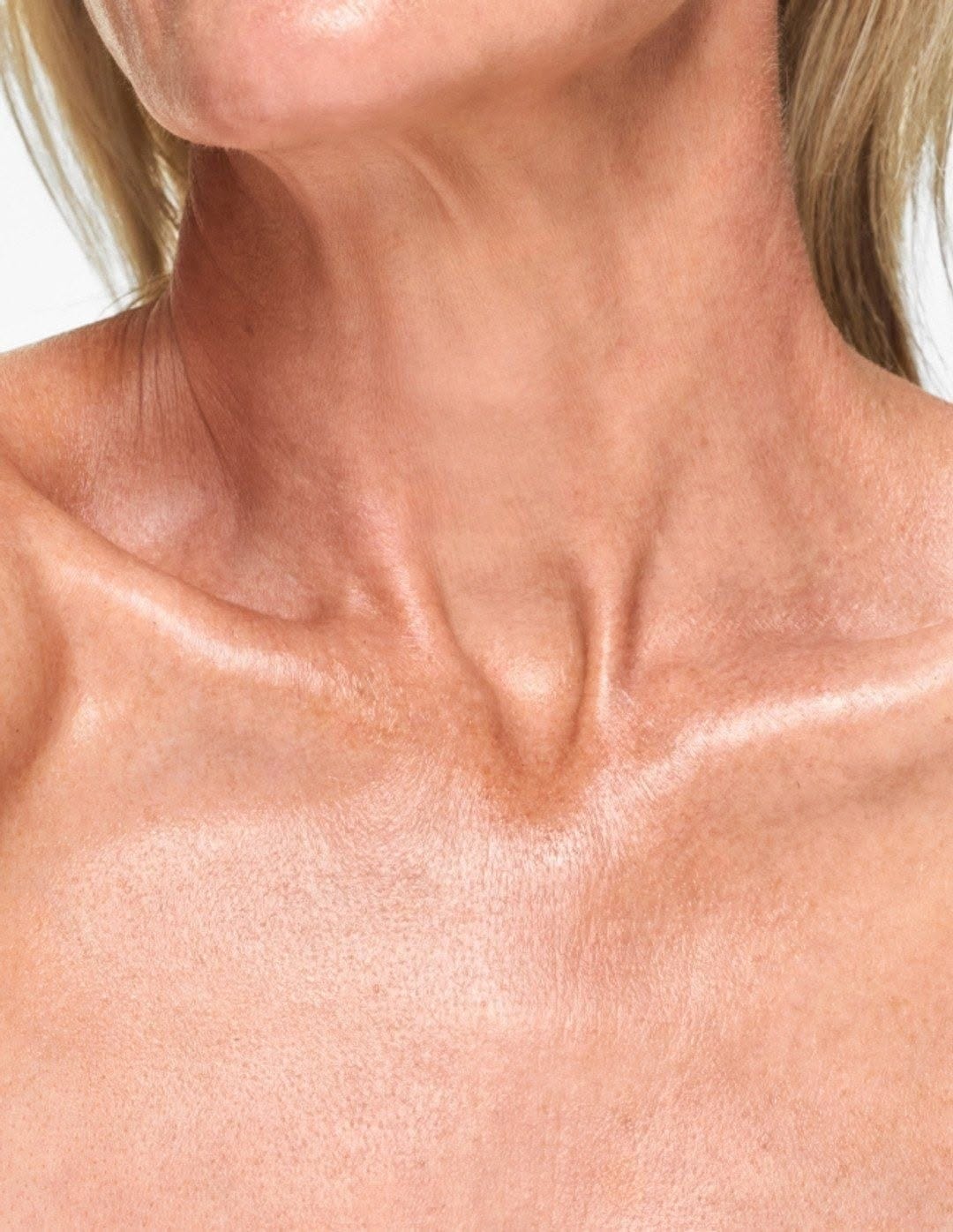 Post 3 by Prestige clinics on Instagram (image)