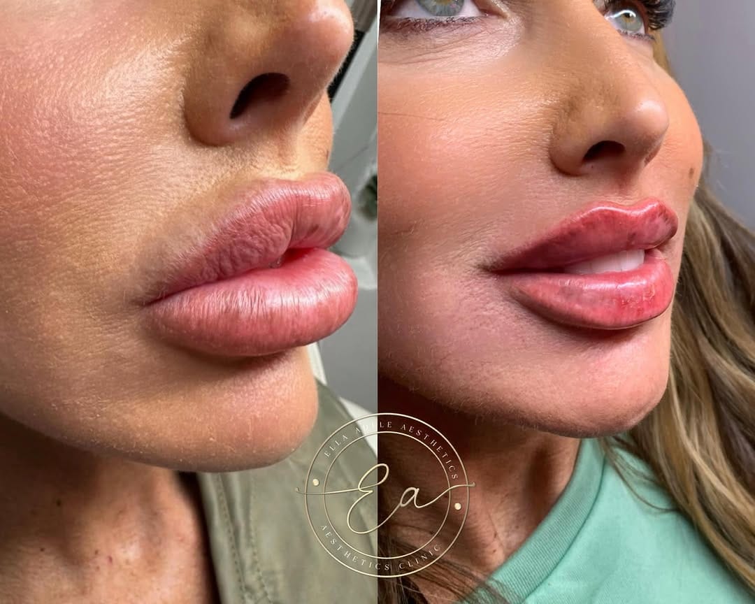 Post 9 by Ella Adele Aesthetics on Instagram (image)