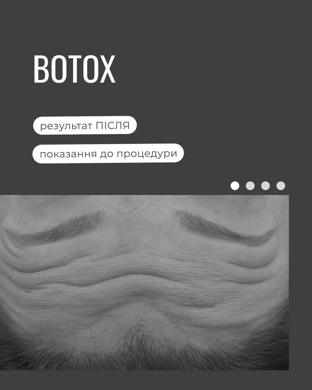 Post 3 by Julia| COSMETOLOGIST | ДИПЛОМОВАНИЙ ТРЕНЕР | LONDON🇬🇧 on Instagram (carousel)