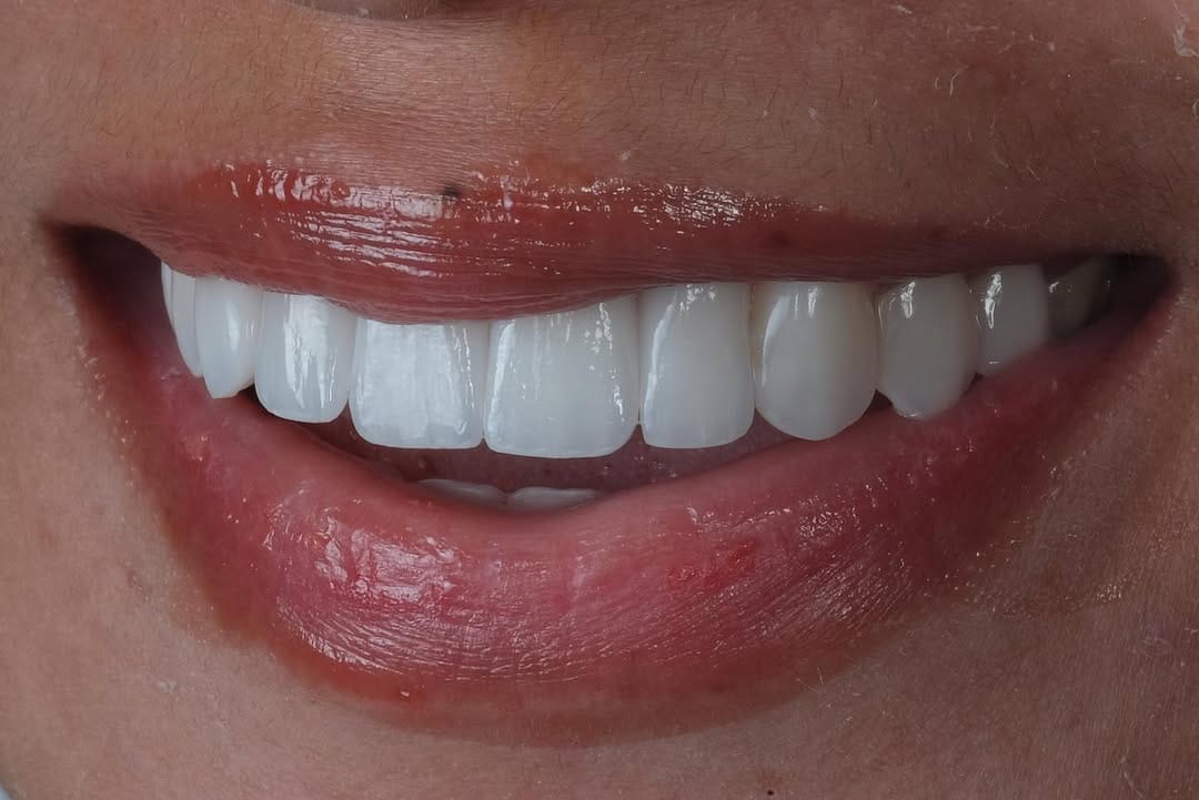 Post 9 by KLINIK GIGI • DOKTER GIGI • CS DENTAL LAB JAKARTA on Instagram (carousel)
