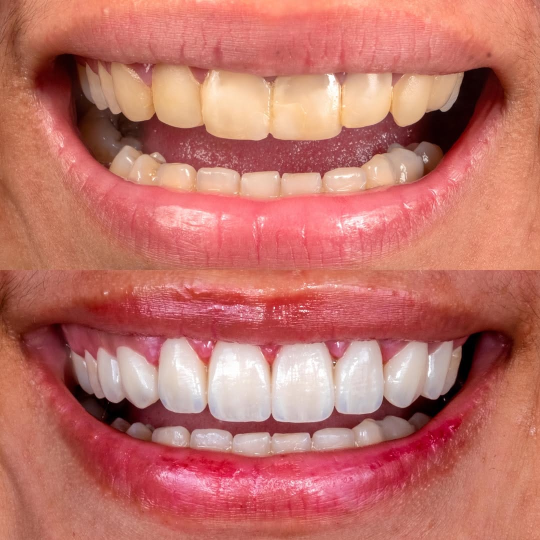 Post 8 by KLINIK GIGI • DOKTER GIGI • CS DENTAL LAB JAKARTA on Instagram (image)