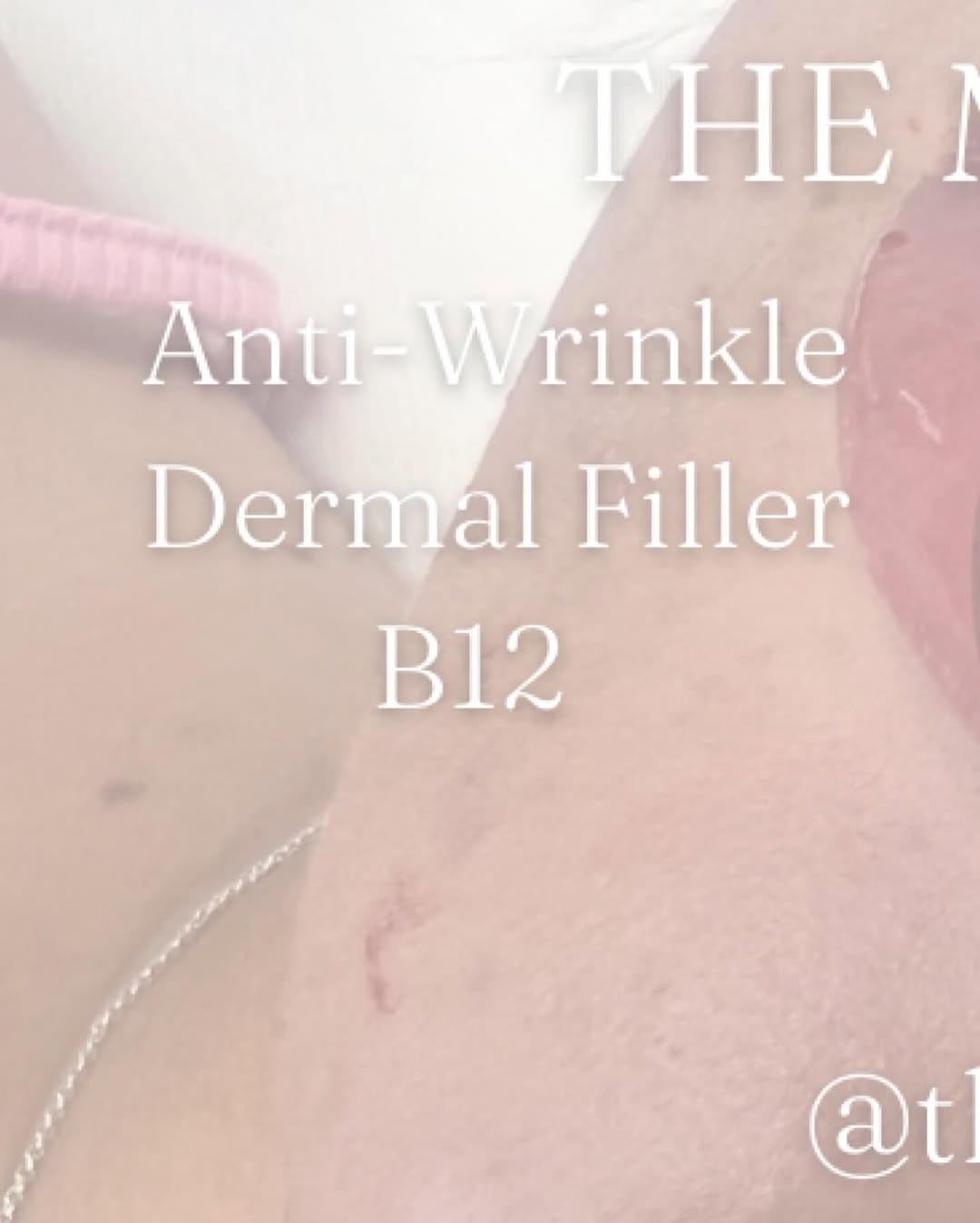 Post 8 by The Mirror Image Beauty & Aesthetics on Instagram (image)