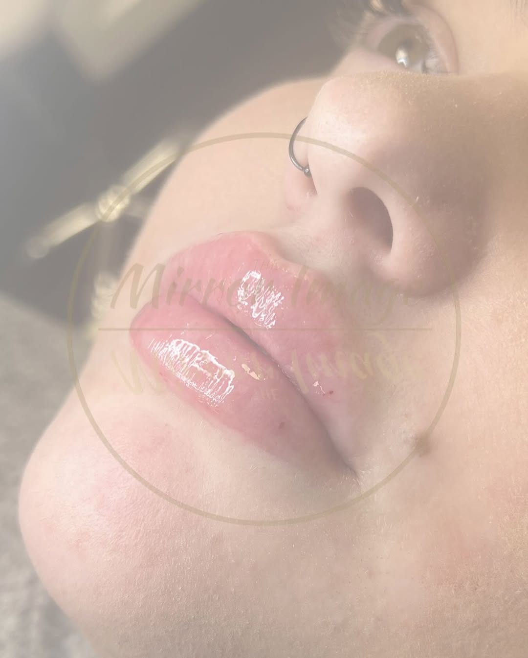 Post 1 by The Mirror Image Beauty & Aesthetics on Instagram (image)